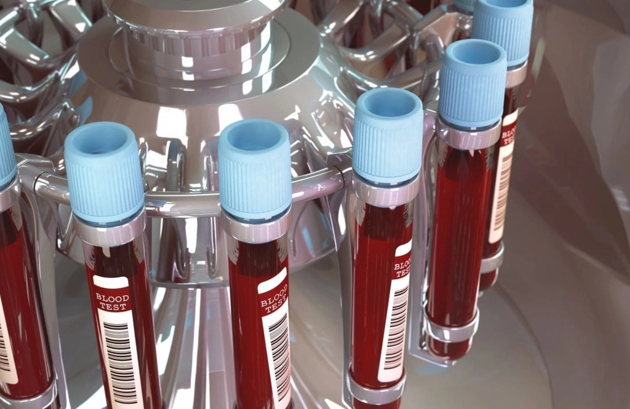 A row of blood samples in bottles on top of a rack.